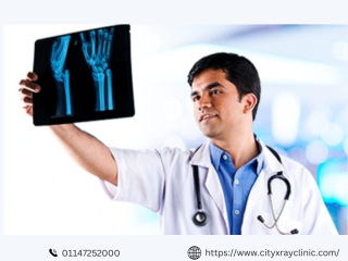 Know the Latest X Ray Price Near You Quick Cost Guide