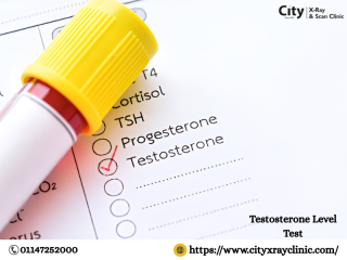 Testosterone Level Test Price Guide Check Cost Easily
