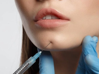 Sculpt Your Jawline with Chin Fillers in Delhi