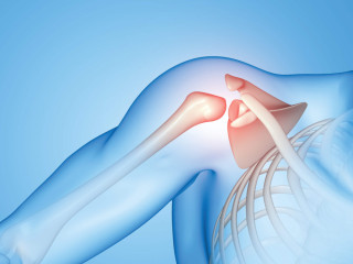 Best Shoulder Replacement Surgeon in Ahmedabad